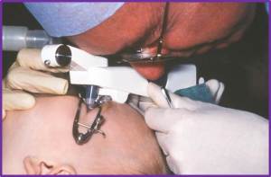Dr Martin infantile glaucoma 2